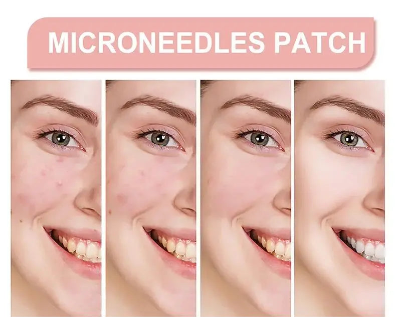 Patch Anti-Boutons